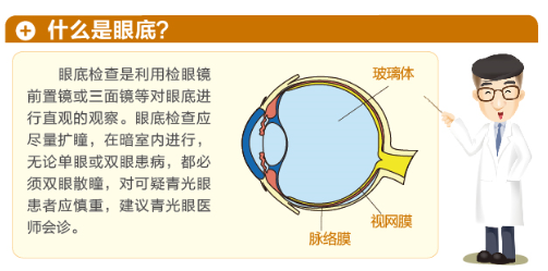 【圖文解答】哪些人更需要做眼底檢查